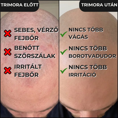 Trimora Start Kezdőcsomag