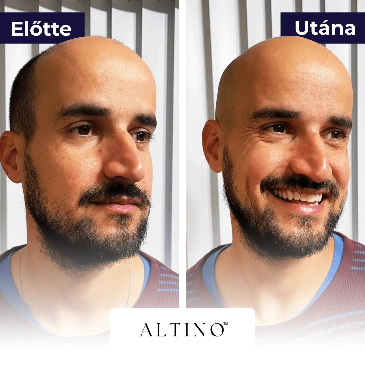 TRIMORA 5 AZ 1 BEN BOROTVA - Altino