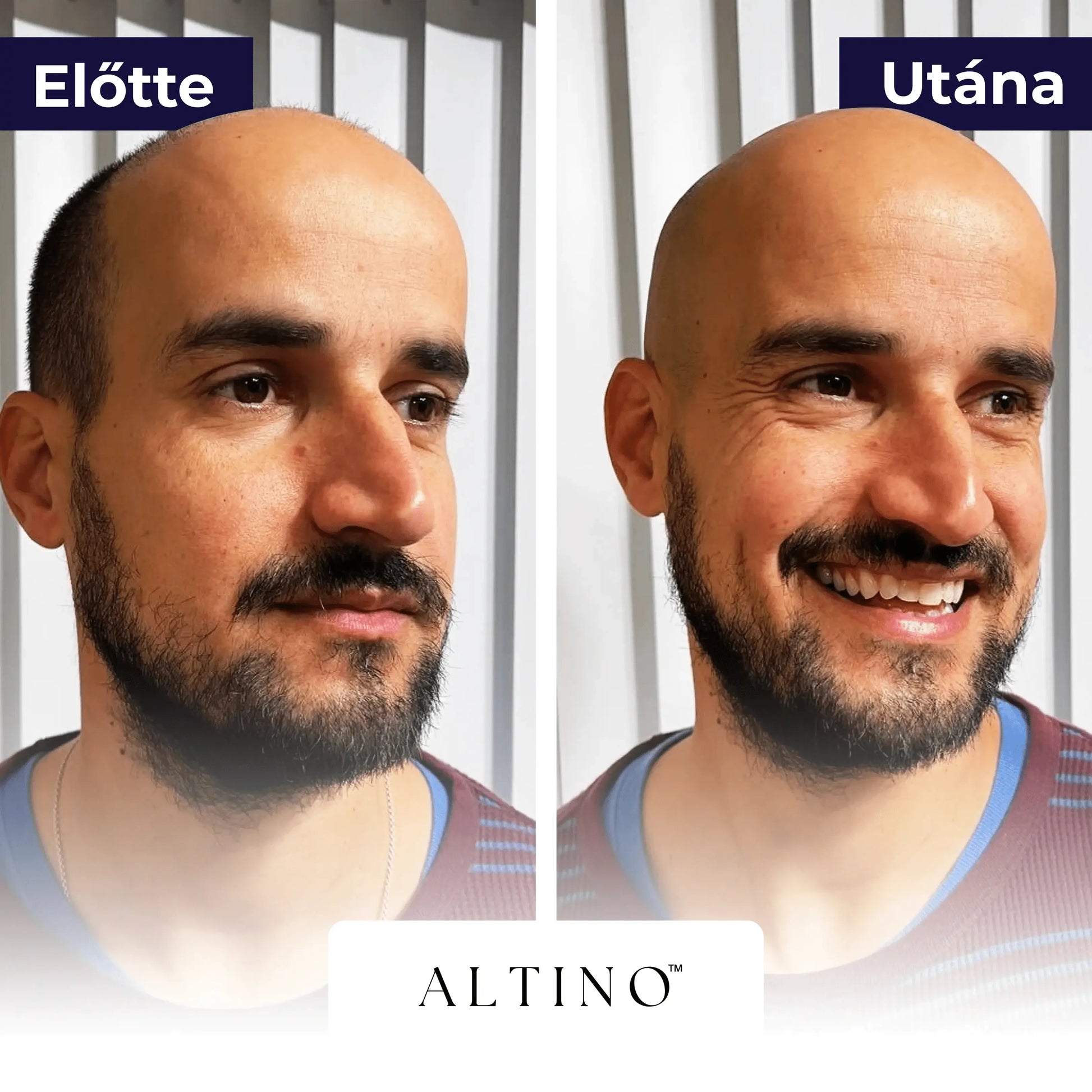 TRIMORA 5 AZ 1 BEN BOROTVA - Altino
