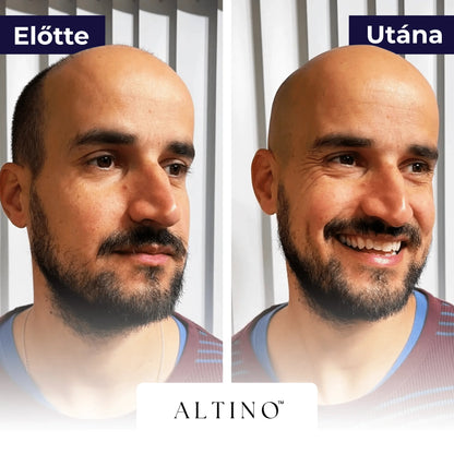 TRIMORA 5 AZ 1 BEN BOROTVA - Altino